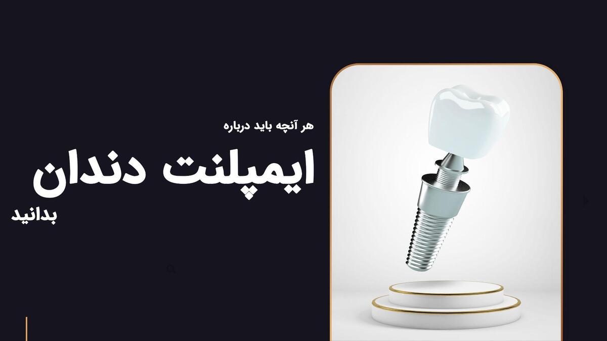 آشنایی با ایمپلنت دندان