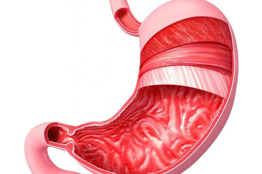 عوارض قرص هیرویت برای معده